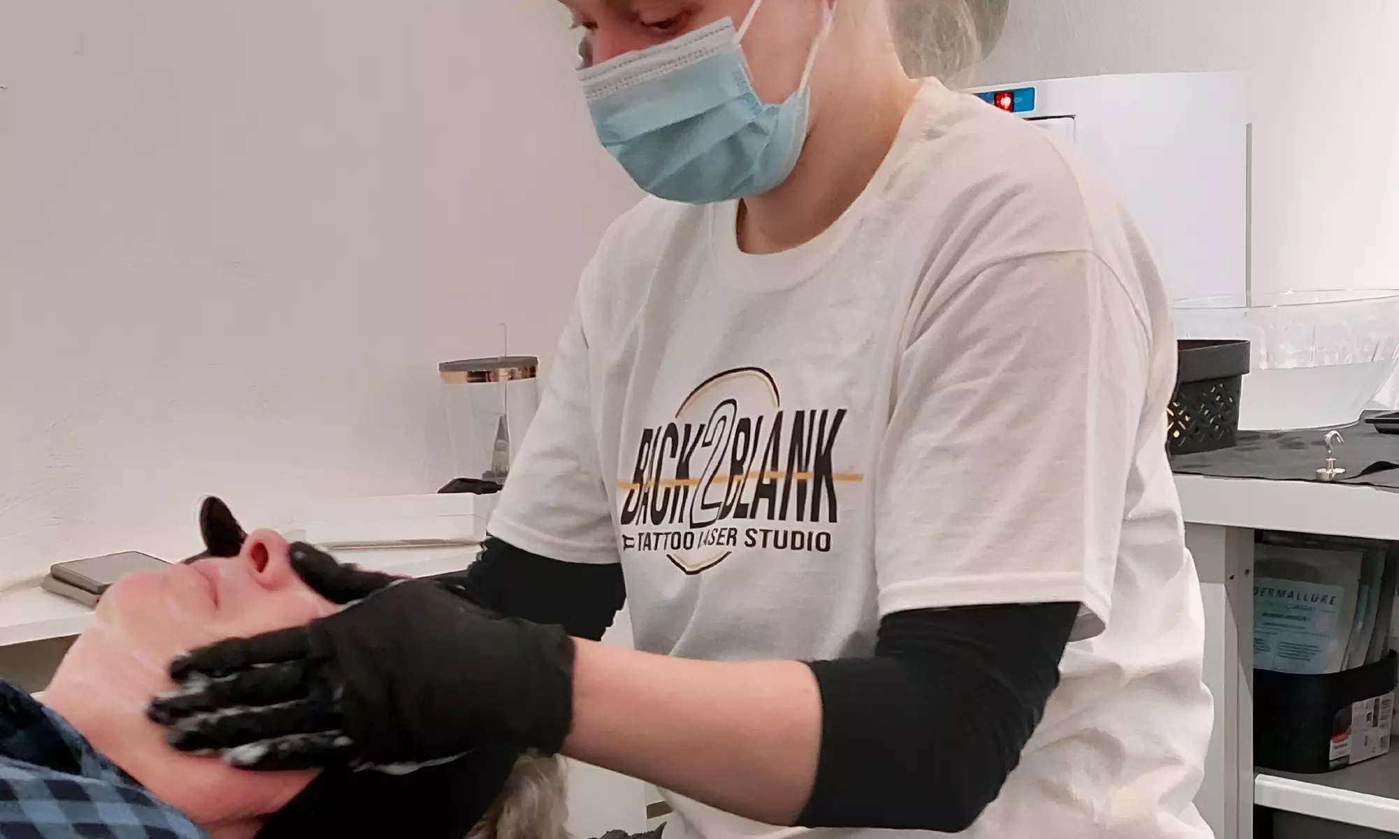 Effectieve carbon laser peeling voor huidverjonging en collageenboost