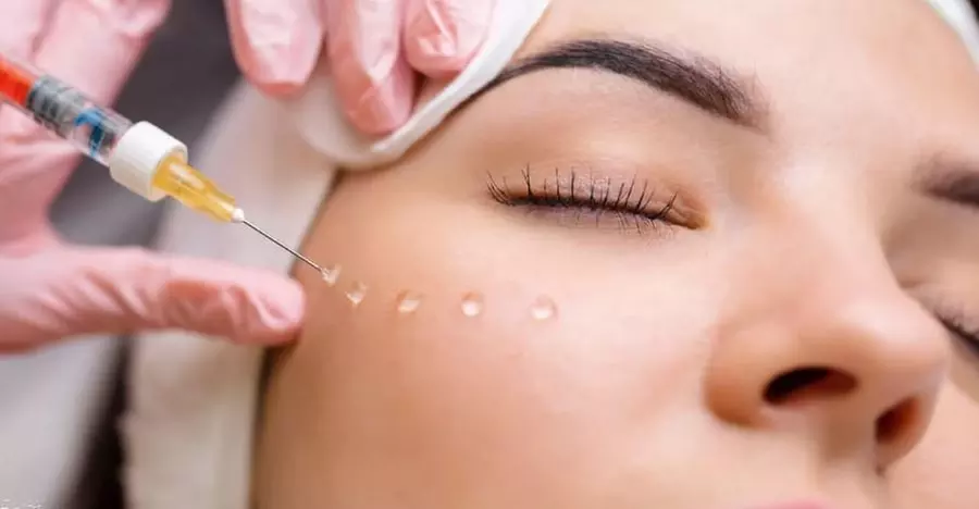 Lippenunterspritzung oder Faltenbehandlung mit Hyaluron für 1 Person