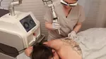 Laser Tattoo Removal Packages for Black Ink Tattoos
