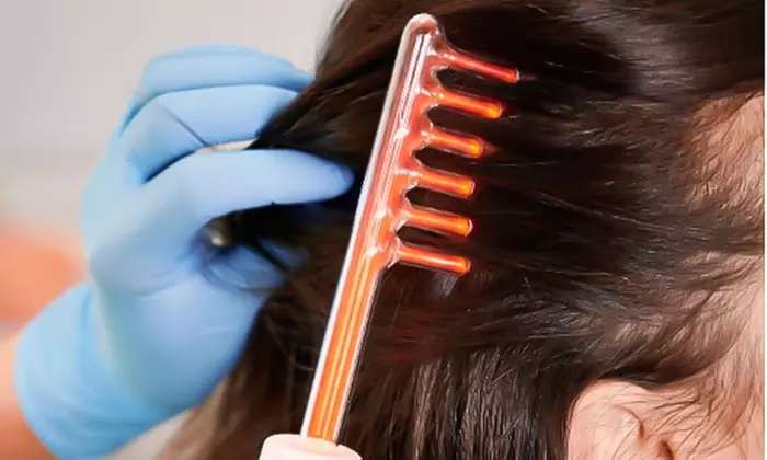 Tratamiento capilar regenerativo con alta frecuencia