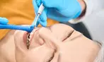 Thorough Dental Care: Exam, Cleaning & X-rays for One or Two