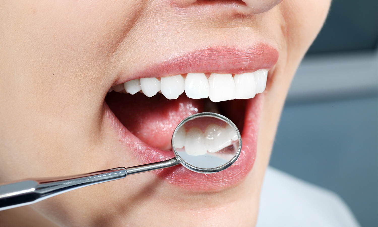 Do 40% zniżki: skaling, piaskowanie i kontrola uzębienia