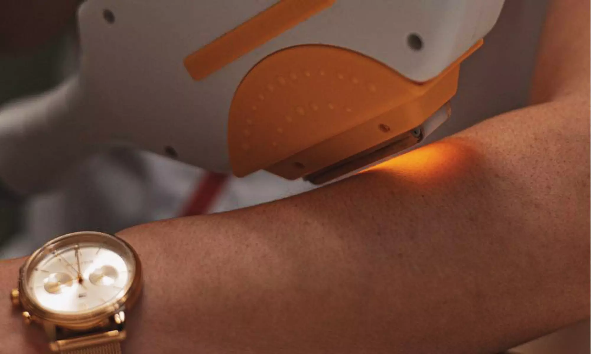 Bis zu 79% Rabatt auf Laser-Haarentfernung