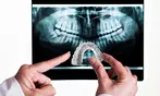 Unlock a Radiant Smile with Dental Services: Veneer, Invisalign & More