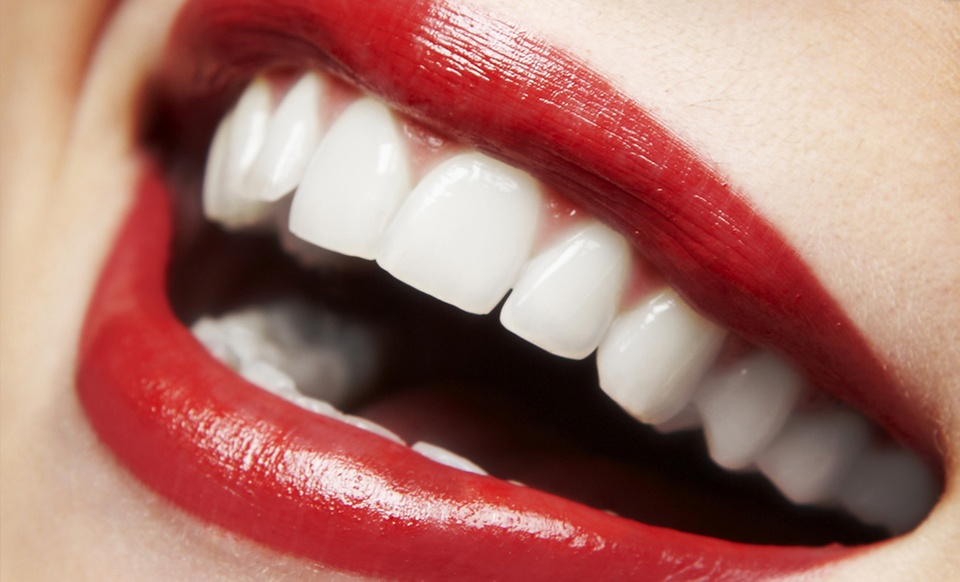 Dental Check-Up with Optional Stain Removal, or Laser Teeth Whitening