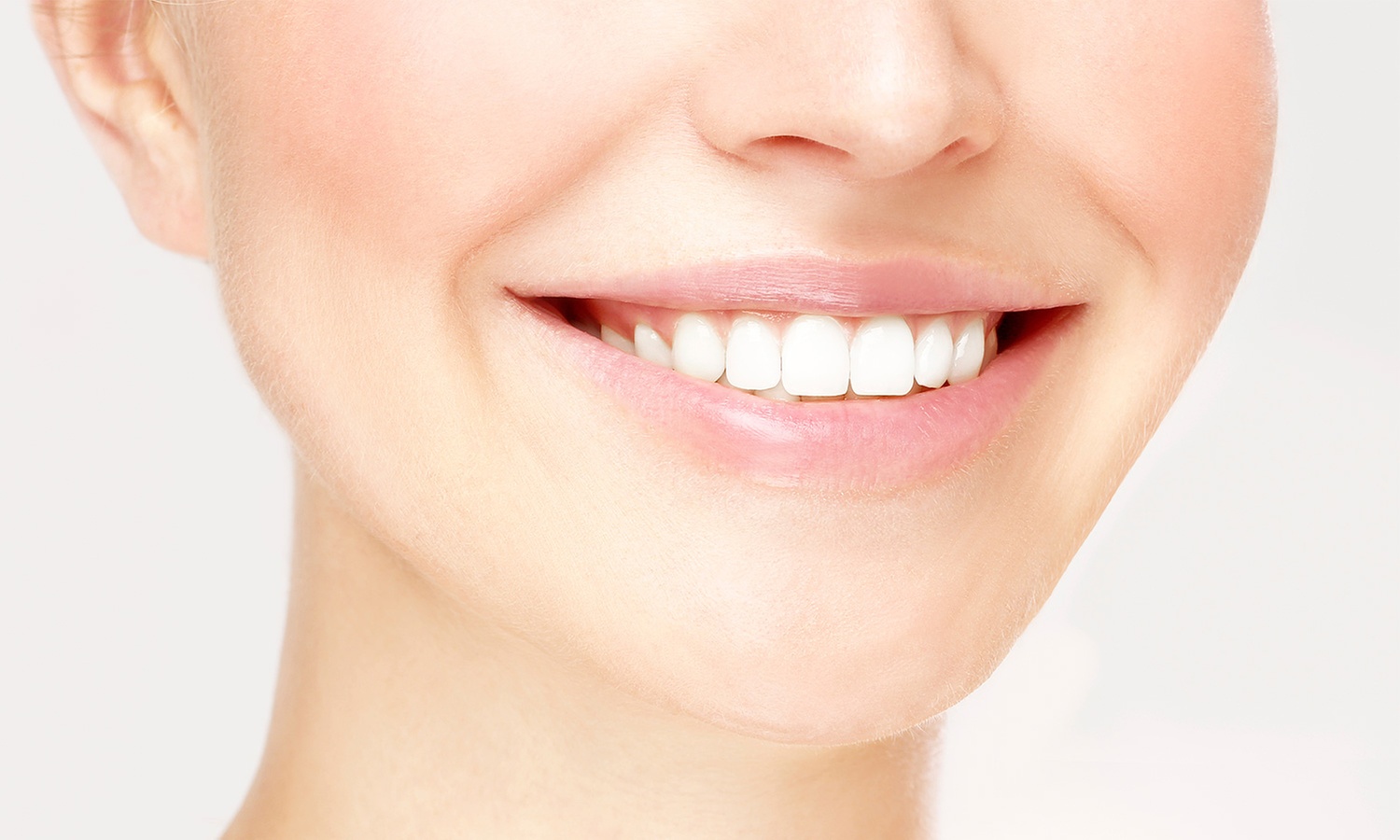 Ortodoncia en ambas arcadas, -90%