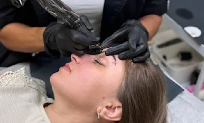 Transform Your Skin with 90-Minute Micro-Needling Sessions