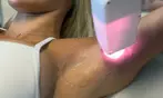 UNLIMITED, PAIN FREE Laser Hair Removal at Euphoria Aesthetics