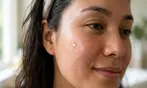Hydrofacial: Exfoliate, Cleanse, Hydrate & Revitalize Your Skin