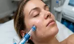 Hydrofacial: Exfoliate, Cleanse, Hydrate & Revitalize Your Skin