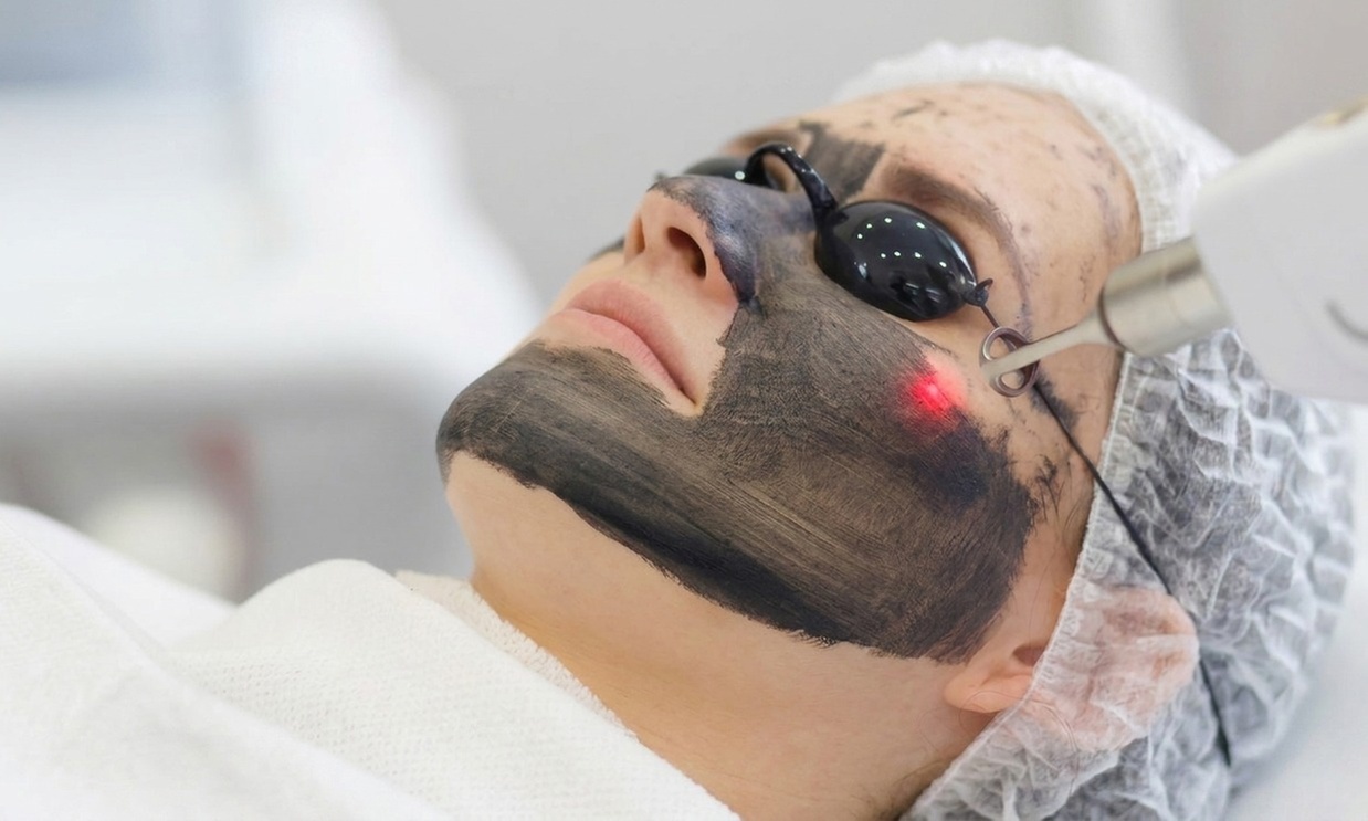 Laserowy peeling węglowy Black Doll na twarz, szyję i dekolt
