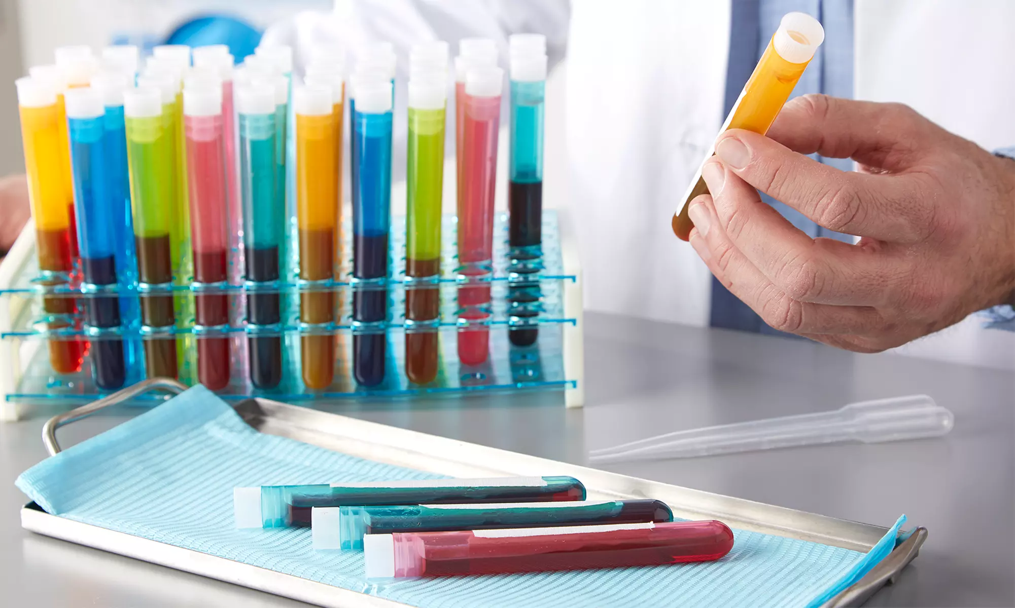 Pakiet badań laboratoryjnych w kierunku insulinooporności