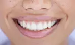 Brighten Your Smile: Express, Zoom or Dr. Smiles Teeth Whitening
