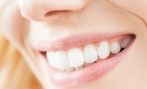 Brighten Your Smile with 30 to 60-Minute Teeth Whitening Sessions