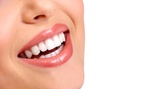 Up to 90% Off Dental Care at Dream Smiles Dental Arts