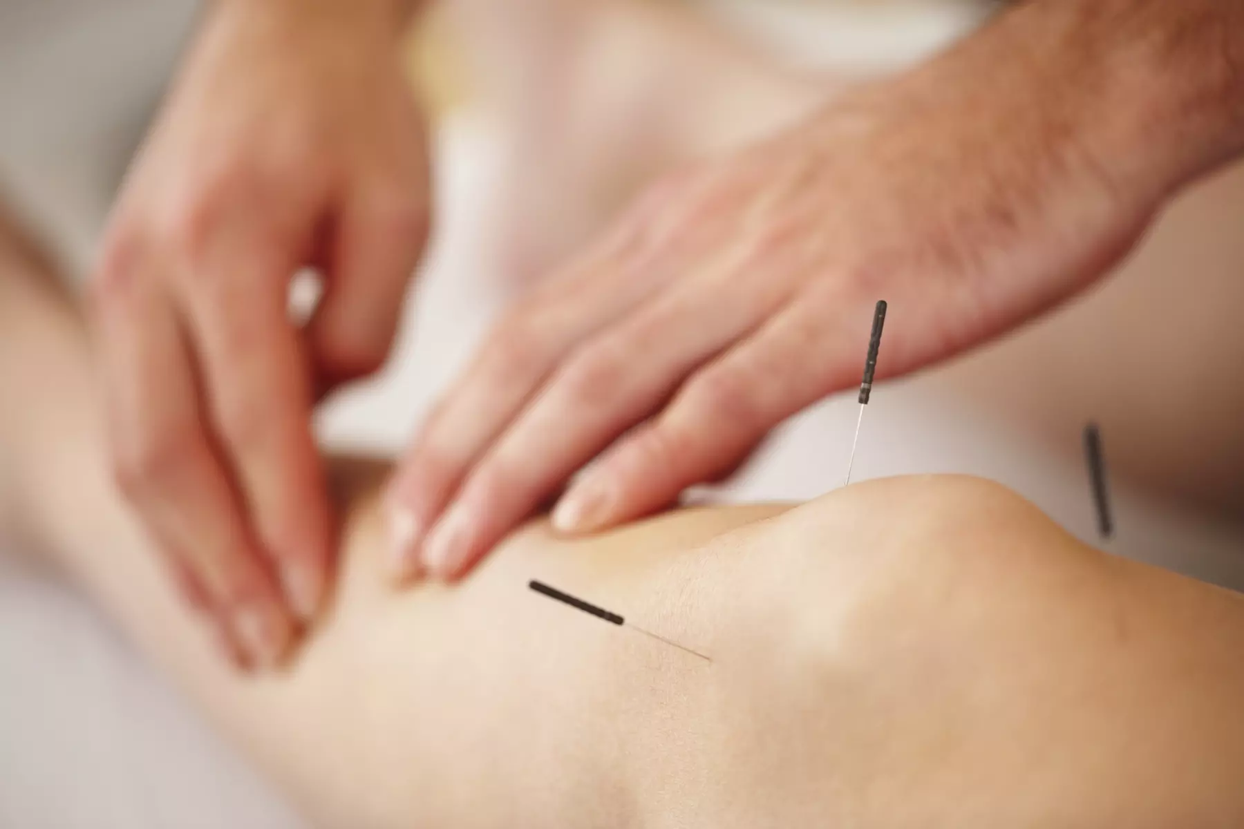 Explore Healing with 30 or 45 Minute Acupuncture Sessions