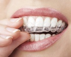 Dental Exam, Xrays, and $1000 Credit Towards Invisalign at Art of Cosmetic Dentistry