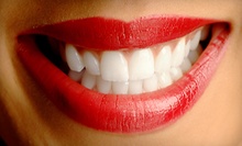 $60 for a Cleaning, X-Ray and Exam at Bella Dental Group