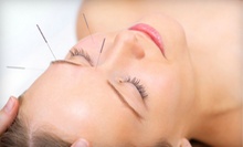 $19 for a One-Hour Acupuncture Session with Cupping at ON Acupuncture Clinic
