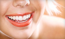 $300 for Zoom Teeth Whitening at Vanguard Dental