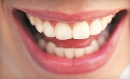 $47 for Dental Cleaning, Exam & X-Rays at San Diego Dental Arts $47 for Dental Cleaning, Exam & X-Rays at San Diego Dental Arts