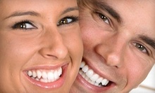 $129 for Full Service, Laser Teeth Whitening Service at Magic Smile