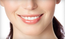 $205 for a Dental Cleaning, Exam and Bitewing X-Rays at A Shop for Smiles San Diego
