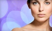 $99 for $150 at Jeta Skin Care and Laser Center