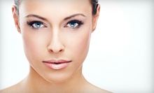 $70 for a Microdermabrasion at Body By Leverett