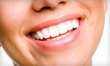 $25 for an Exam, X-Rays, and Coronal Polish at Otay Lakes Dental Group