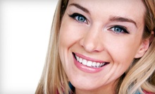 $60 for an Exam and Adult Cleaning at Advanced Dental