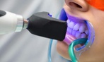 Whiten Your Teeth with Advanced In-Office Treatments