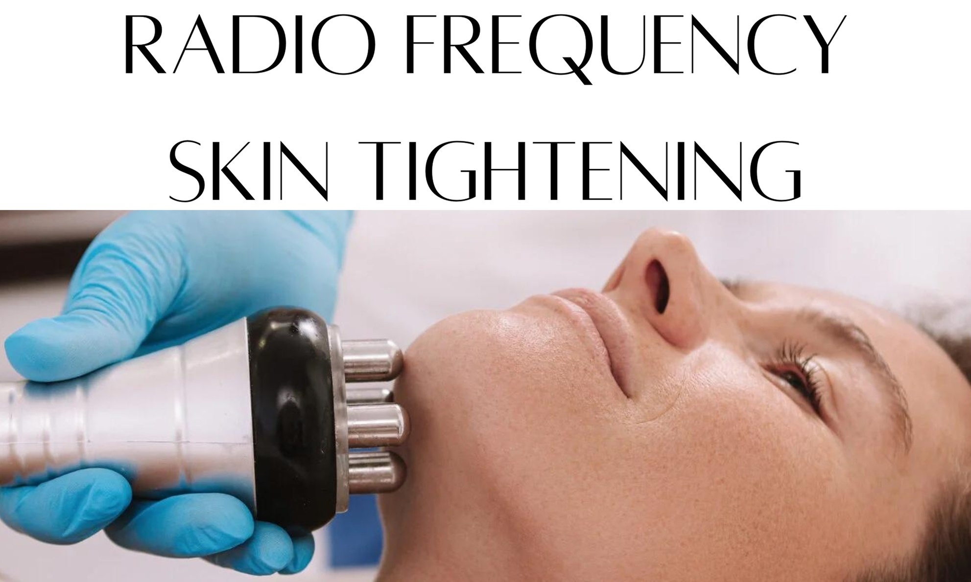Up to 65% Off on Radio Frequency Skin Tightening at Beauty Molding Studio