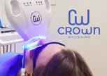 One-Hour Phillips Zoom Laser Teeth Whitening with Consultation at Green Dental Ltd in Dublin (Up to 40% Off)
