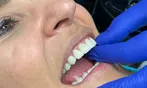 Up to 87% Off on Dental Checkup at Sonrie Dental Studio