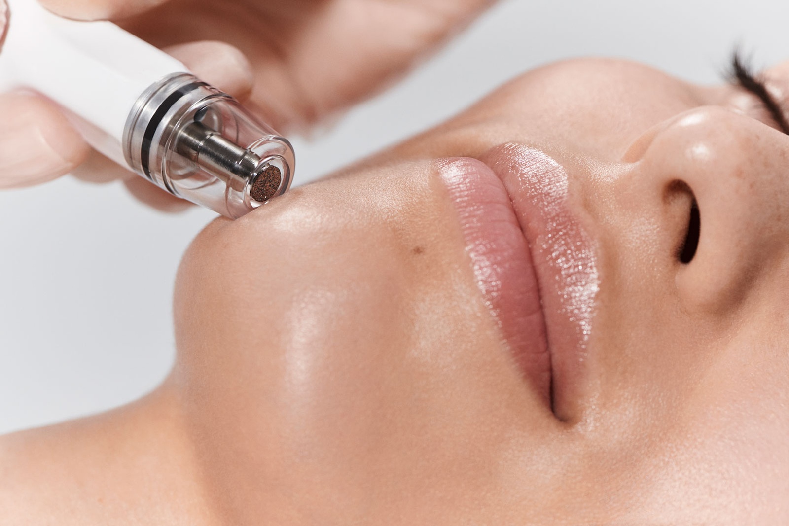 Facial - Diamond Peeling at H.S. Medical Aesthetics & Wellness Center
