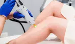 Up to 61% Off on Laser Hair Removal at InSkin Laser Aesthetics