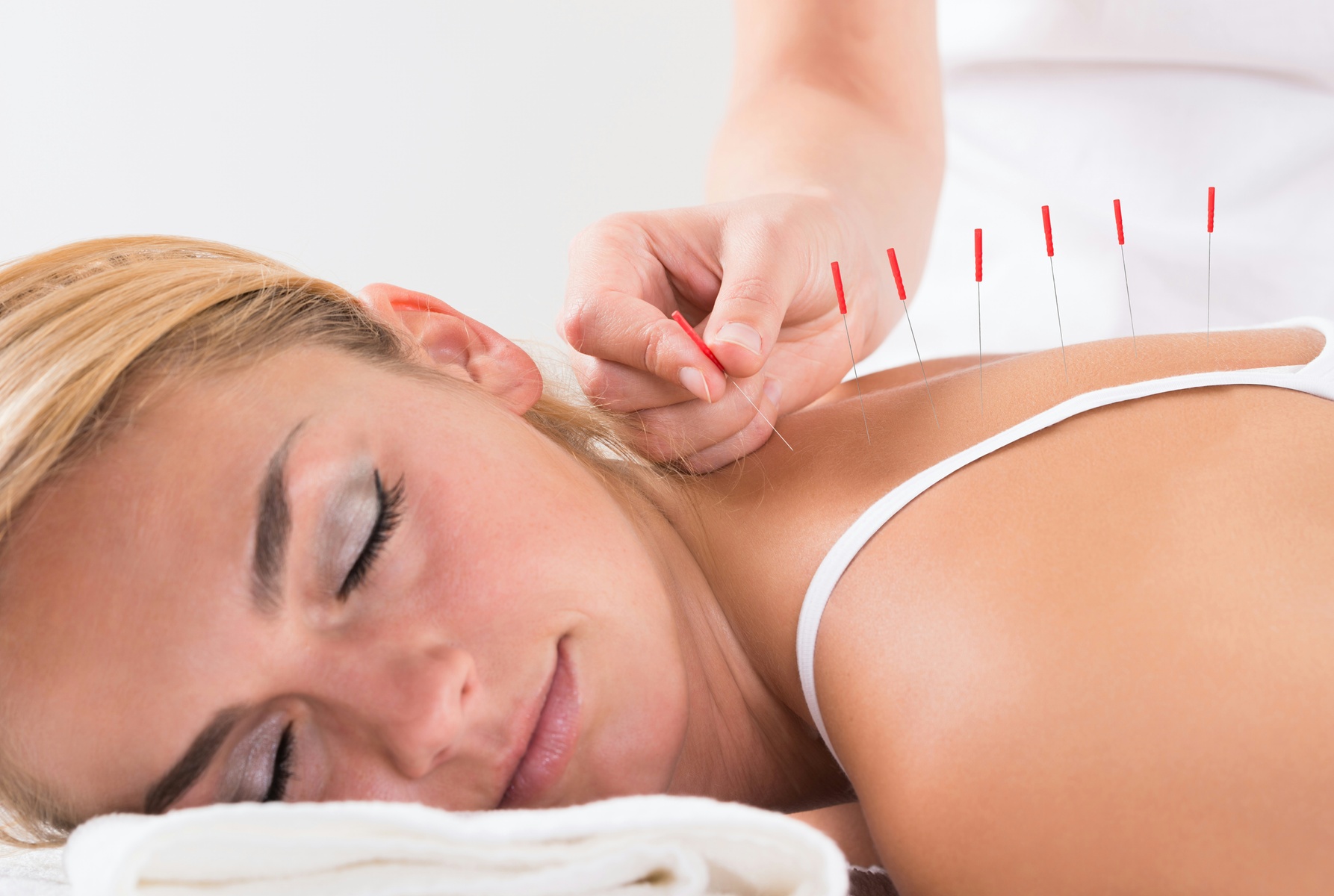 Up to 84% Off on Acupuncture Services at HEALTH