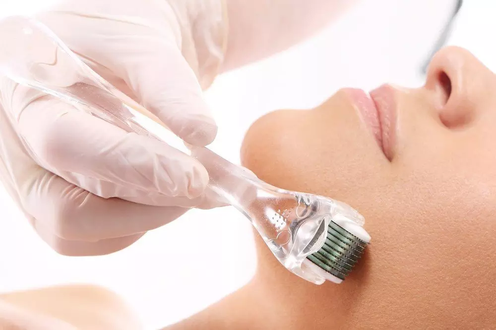 Up to 50% Off on Micro-Needling at PBS Spa