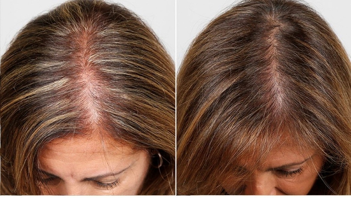 Up to 67% Off on Salon - Hair Straightening Treatment at UK Aesthetics Lounge