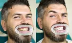 Double or Triple Treatment In-Office Teeth Whitening using Organic Gel & LED Laser Light (Up To 72% Off)