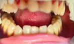 Up to 89% Off on Teeth Whitening - In-Office - Branded (Beyond, Power) at Your Covina Family Dentistry