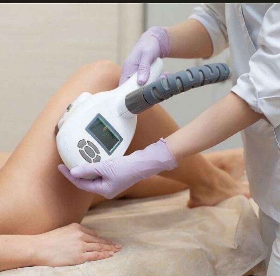 Three Velashape Treatments for Fat and Cellulite Reduction