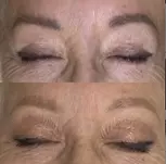 Experience Laser By Nicole - Fort Lauderdale with three tattoo removal treatments for various area sizes up to 37% off