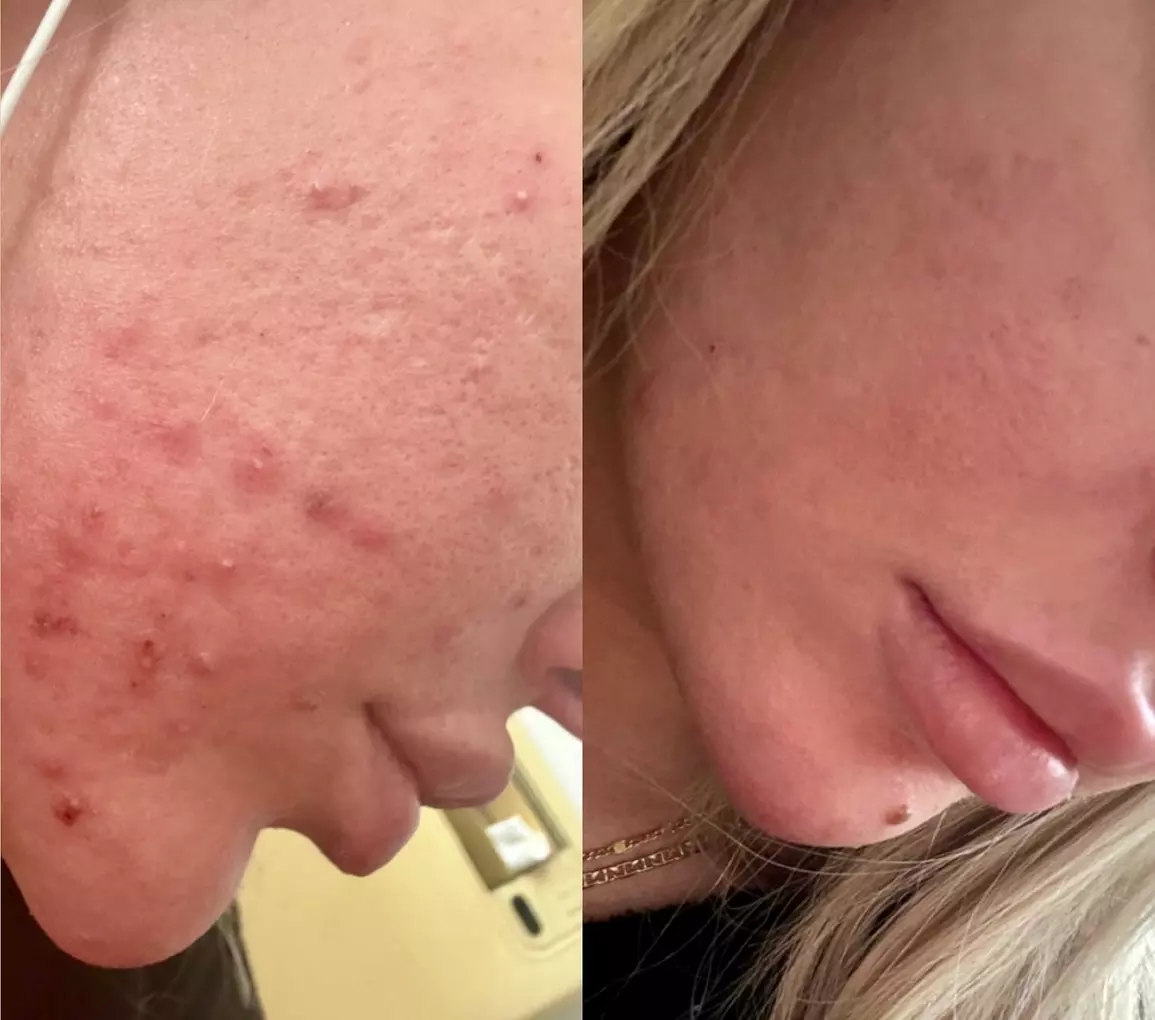 Experience a Revitalizing VI Peel or Diamond Glow Facial at Enigma Medi Spa & Laser Center (Up to 44% Off)