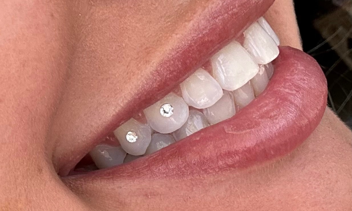 Austrian Crystal Tooth Gems, Crystal Butterfly, Silver Bracelet & More