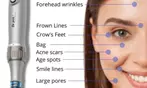 Up to 60% Off on Micro-Needling at Skinneon Beauty