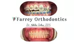 Complimentary Orthodontic Evaluation & Consultation