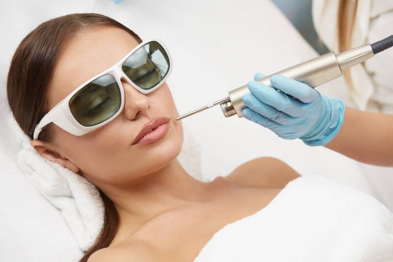 Up to 56% Off on Fotona Erbium Laser Skin Resurfacing at XS MedSPA