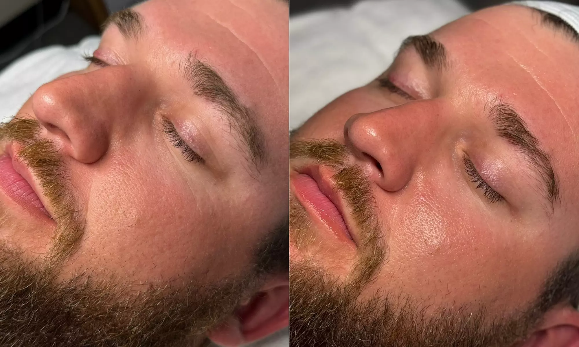 Unleash Radiance: Transform Your Skin w/ Customized Facial Adventure!